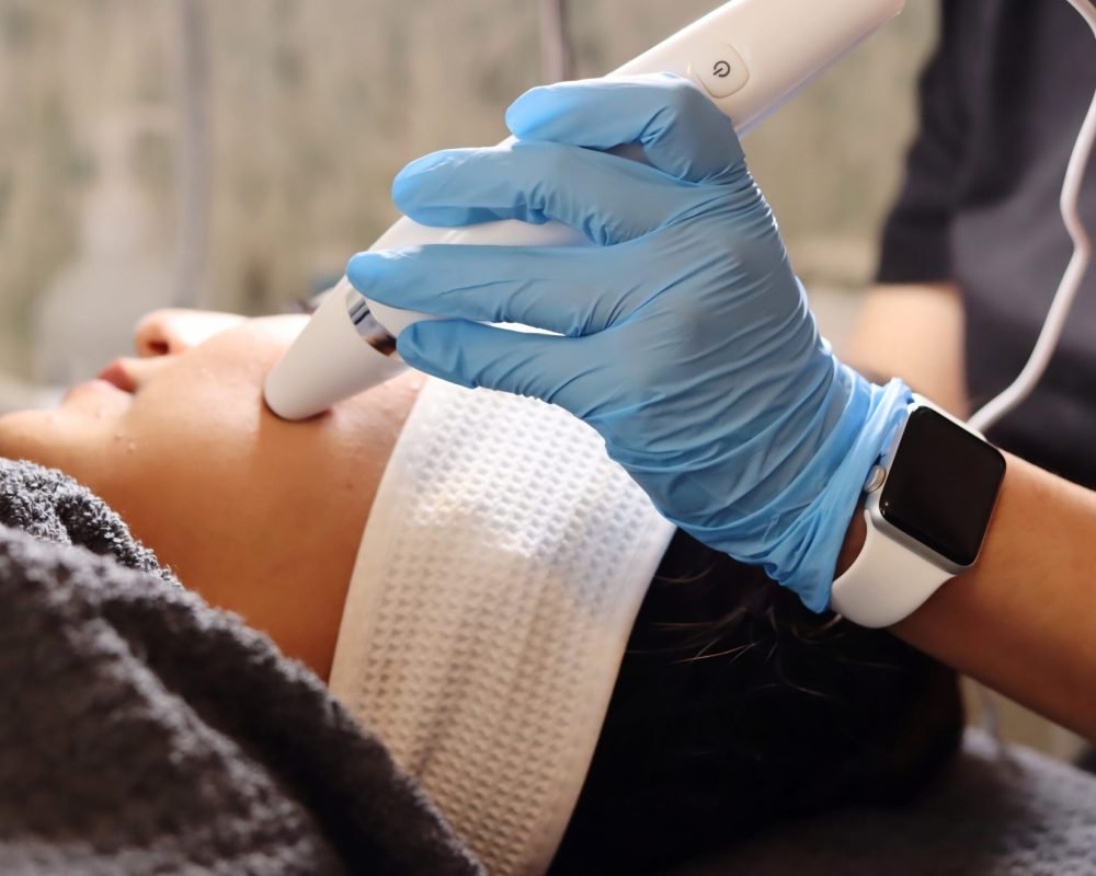 Micro derma brasion Facial